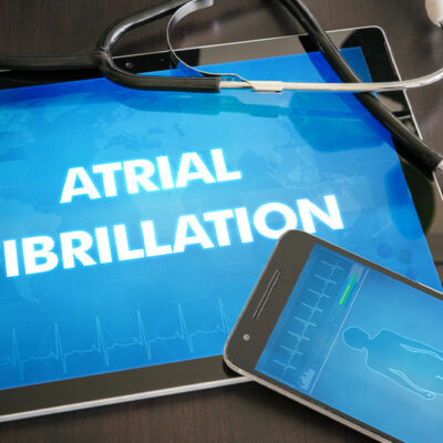 Atrial fibrillation &#8211; Causes, symptoms, and management tips