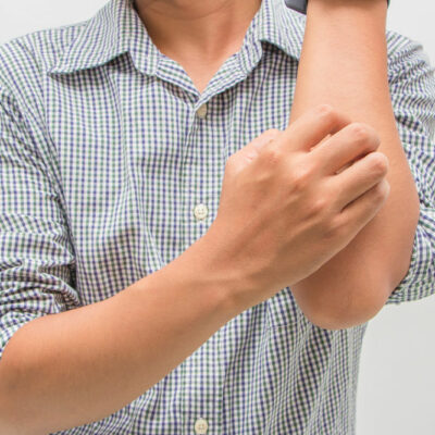 Eczema &#8211; Types, symptoms, causes, and management