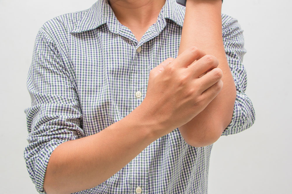 Eczema &#8211; Types, symptoms, causes, and management