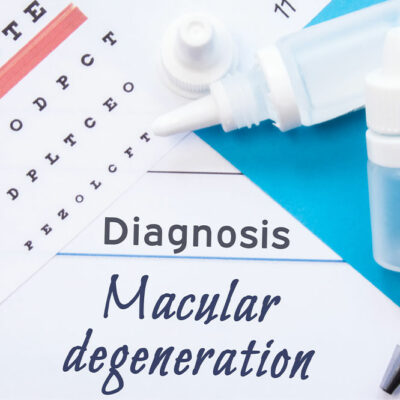 Key facts about age-related macular degeneration