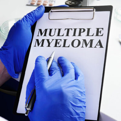 Multiple Myeloma &#8211; Symptoms, and Management Tips