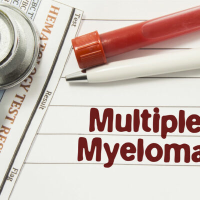 Never Ignore These 7 Signs of Multiple Myeloma