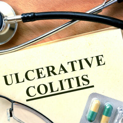 Simple tips for managing ulcerative colitis