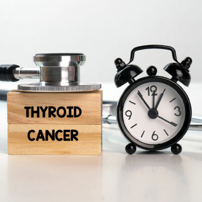 Thyroid cancer &#8211; Causes, Symptoms, and management